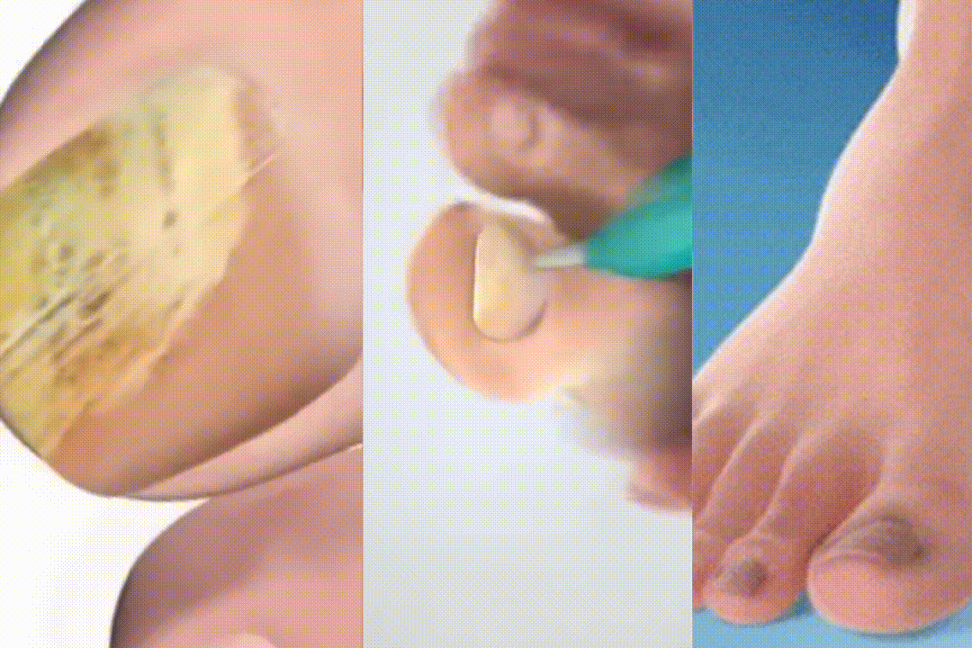 clarivia how to use